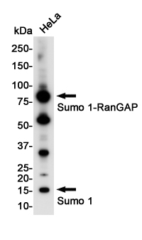 IHC - SUMO1 Rabbit mAb AP76133